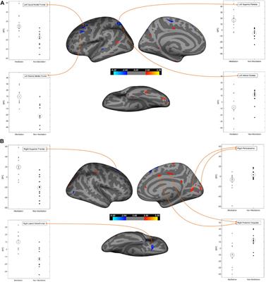 Effects of Meditation on Structural Changes of the Brain in Patients With Mild Cognitive Impairment or Alzheimer’s Disease Dementia